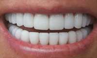 چهار نکته ای که در مورد دندان هایتان نمی دانستید.