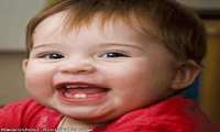 مهمترین عامل پوسیدگی دندان در کودکان کشف شد.